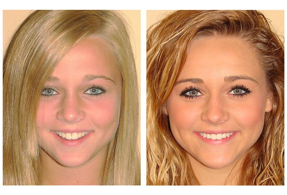 Brentwood Progressive Dental